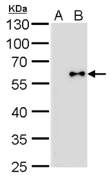 Anti-Influenza B virus Nucleoprotein antibody [GT371] used in Western Blot (WB). GTX629882